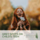 Grey-Spots-on-Childs-Teeth